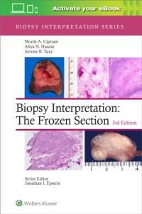 Biopsy Interpretation: The Frozen Section: Print + eBook with Multimedia av Nicole A. Cipriani