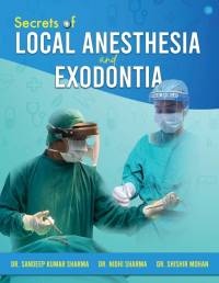 Secrets of Local Anesthesia and Exodontia av Sandeep Kumar Sharma