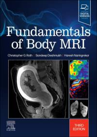 Fundamentals of Body MRI av Christopher G. Roth