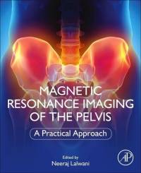 Magnetic Resonance Imaging of The Pelvis av Neeraj Lalwani