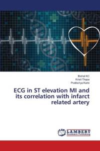 ECG in ST elevation MI and its correlation with infarct related artery av Bishal Kc